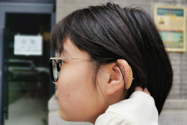 人工耳蜗