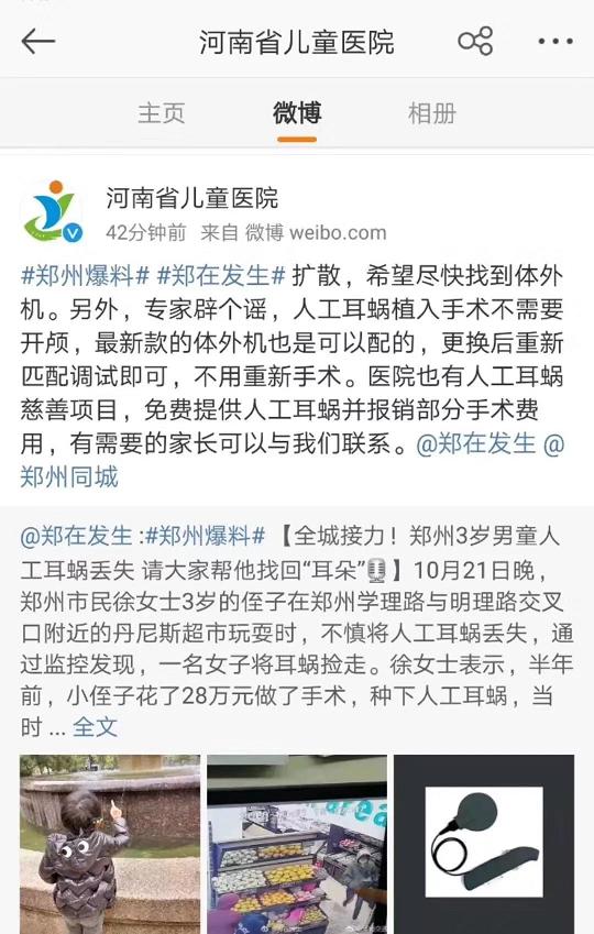 河南人工耳蜗