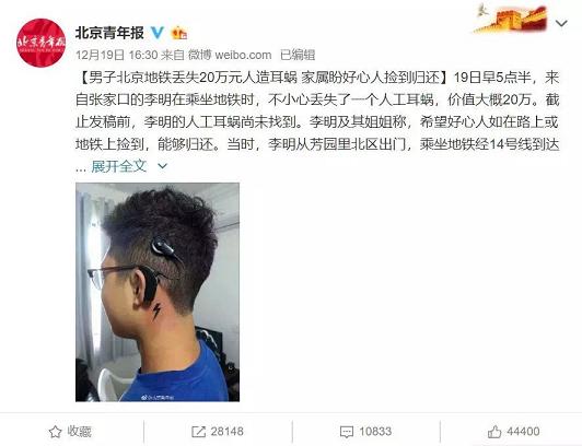 人工耳蜗