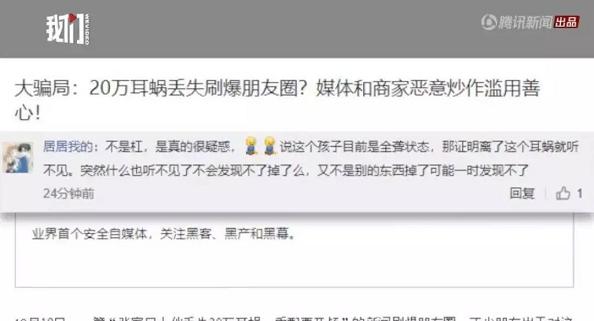 人工耳蜗