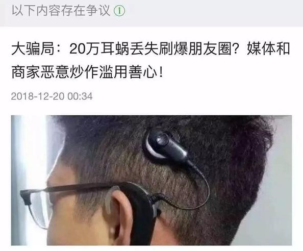 人工耳蜗