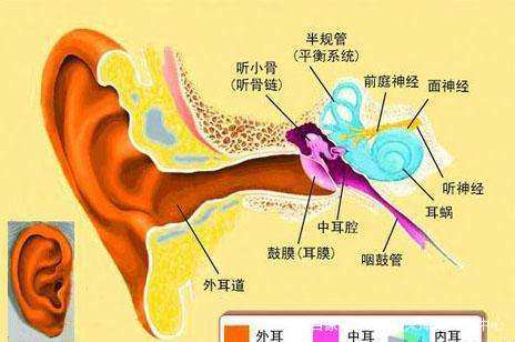 人工耳蜗