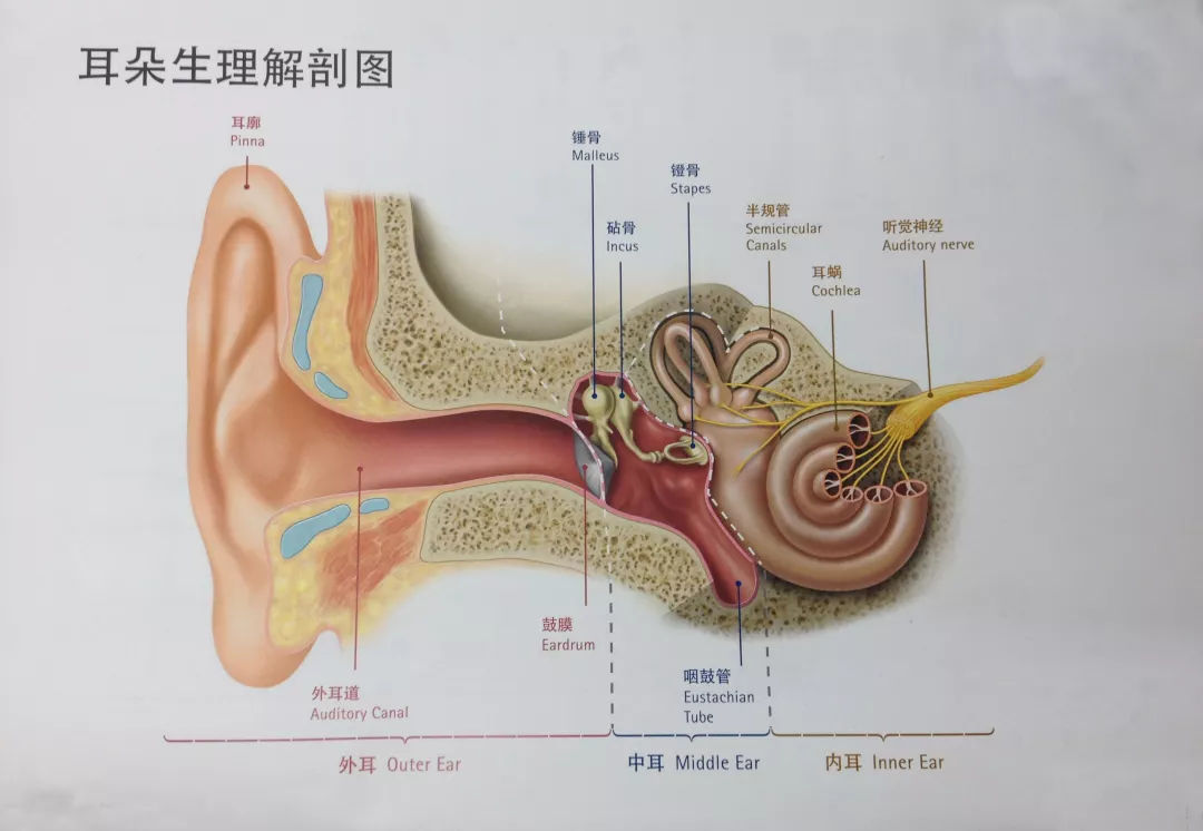 人工耳蜗