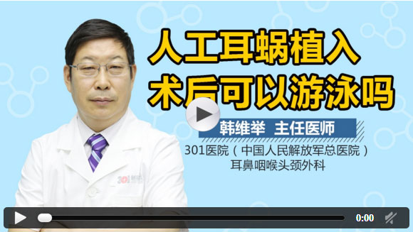 人工耳蜗