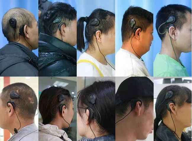 人工耳蜗