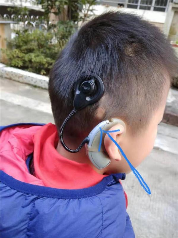 贵州人工耳蜗